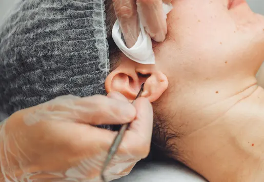 Earwax Removal