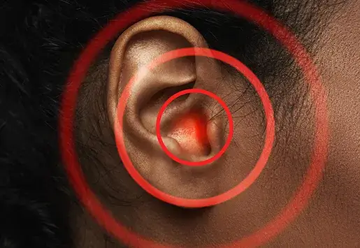 Impacted earwax pain thumb
