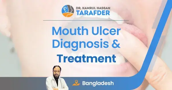 Mouth ulcer treatment in Bangladesh
