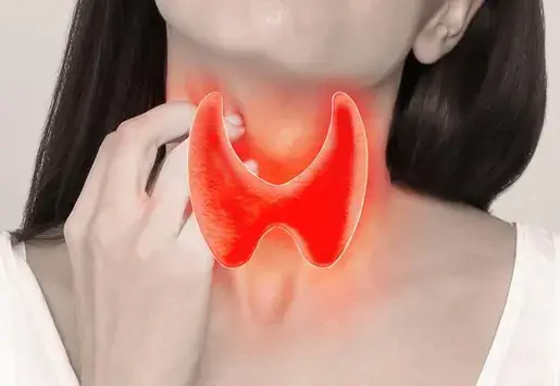 Multinodular Goiter