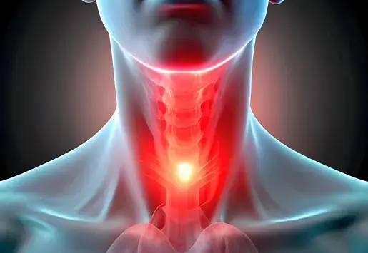 Toxic Goiter Hyperthyroidism